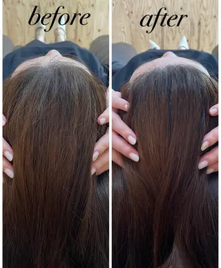 ate'所属・個室ドライヘッドスパ 🍃moriのエステ・リラクイメージ