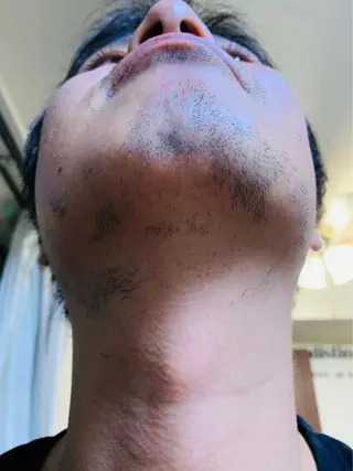 ネイル・脱毛サロンplage所属・脱毛サロン Plageプラージュのエステ・リラクイメージ