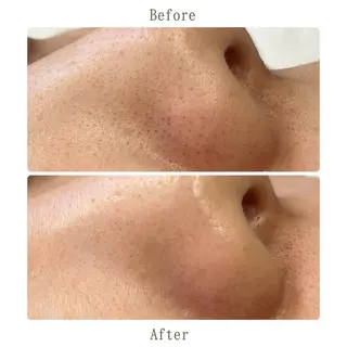 サキ 脱毛.エステ🩵ྀིの眉毛・アイブロウイメージ