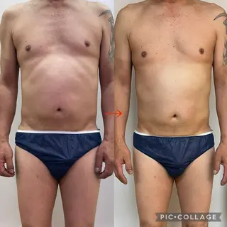 メンズ トータルビューティーサロン LilyRose所属・エステサロン LilyRoseのエステ・リラクイメージ