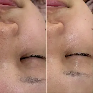 〈etre〉トータルビューティーサロン所属・etre - 韓国肌管理 -のエステ・リラクイメージ