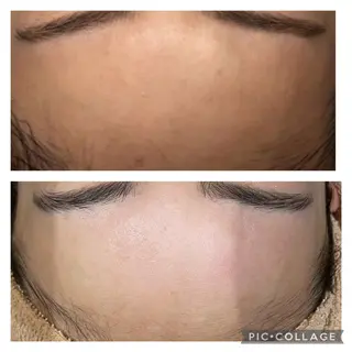 🌈Linora byRAYVIS🌈のエステ・リラクイメージ