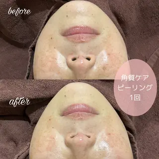 merveilles所属・まつげ/整体/にきび ・アトピー専門サロンのマツエク・マツパデザイン