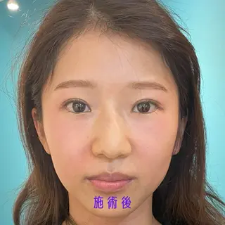 Nexfit for Beauty小顔矯正のエステ・リラクイメージ