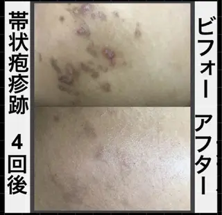 ハーブピーリング専門 COCO.梅田中津のエステ・リラクイメージ