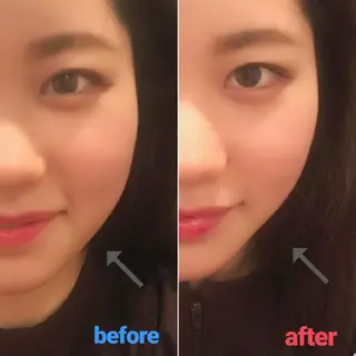 小顔美容鍼灸Acubelle Yakuin.【アキュベル薬院】所属・石川 真梨奈  美容鍼灸/アロマのエステ・リラクイメージ