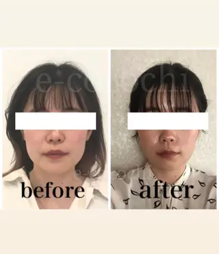 小顔と ヘッドスパのお店のエステ・リラクイメージ