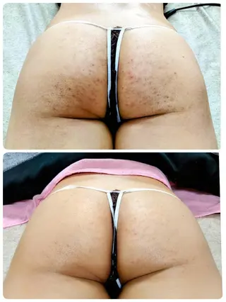 調律エステ /美KISSのその他イメージ