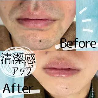 都度払い脱毛 BARNEYのエステ・リラクイメージ