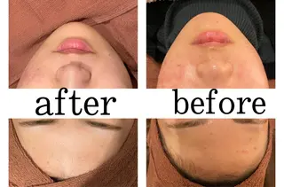 セミロング カラー パーマ ヘアアレンジ メンズ キッズ ネイル マツエク・マツパ アイブロウ ニキビ特化型エステ 🍓最短で肌質改善のエステ・リラクイメージ