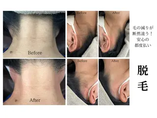 LiLL by Andre beauty所属・LiLL 熊本のエステ・リラクイメージ