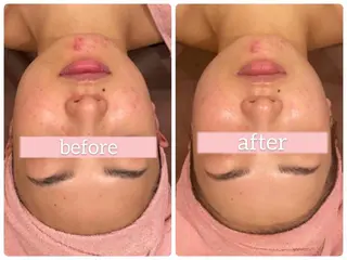 レイビス名古屋♡ 伊波のエステ・リラクイメージ