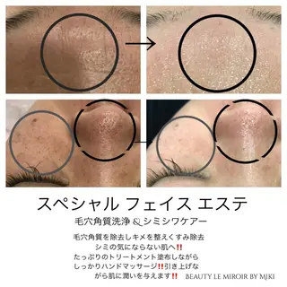 ビューティー ミロワールのエステ・リラクイメージ