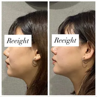 肌質改善専門 ハーブ /毛穴洗浄 リエイトのエステ・リラクイメージ