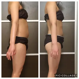 ミディアム カラー パーマ ヘアアレンジ メンズ キッズ ネイル マツエク・マツパ アニメ,Vオタク× 即効痩せエステサロンのエステ・リラクイメージ