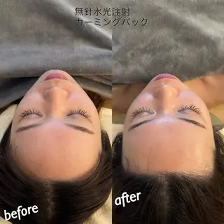 うなじ脱毛/美肌脱毛 LABELのエステ・リラクイメージ