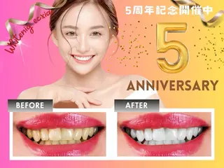 セルフホワイトニング エクシア徳島店のその他イメージ