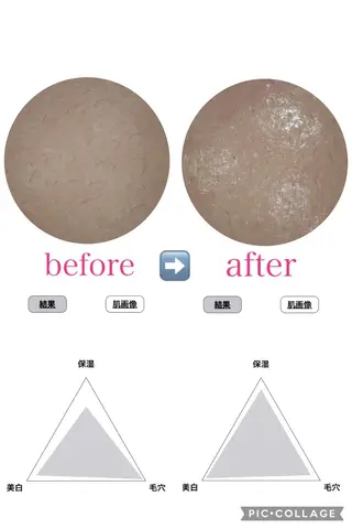 ＲＩＯＮ 〜リオン〜 ／    肌育サロンのエステ・リラクイメージ