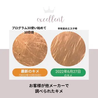 フェイシャルサロン ビアンカガーデンのエステ・リラクイメージ