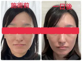 Serapia 【セラピア】のマツエク・マツパデザイン