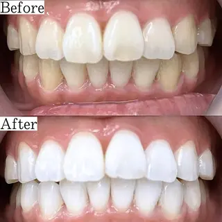 LBSホワイトニング 銀座店💎公式のその他イメージ