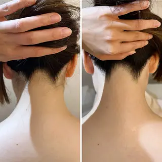 うなじ脱毛/美肌脱毛 LABELのエステ・リラクイメージ