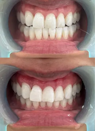 𓂃𓂂ꕤ*.ﾟFullcover𓂃𓂂ꕤ*.ﾟbeauty所属・Fullcover beautyのその他イメージ