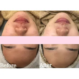 ネイル マツエク・マツパ BestBelleꕤ 大阪福島/肌質改善のエステ・リラクイメージ