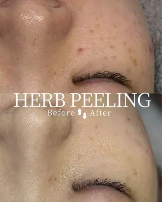 小顔矯正&リンパ専門店EMIER(エミエル)所属・福井二の宮EMIER /ゆきのエステ・リラクイメージ