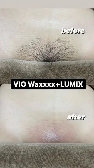 メンズ Epina 千葉店 【エピナ】のエステ・リラクイメージ