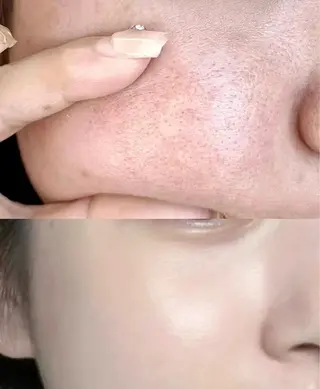 愛維美水光美肌専門店所属・愛維美水光美肌専門店 メンズレディースokのエステ・リラクイメージ