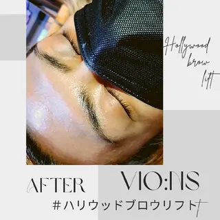 アイブロウ 看護師プロデュース 脱毛『Vio:Ns』のエステ・リラクイメージ