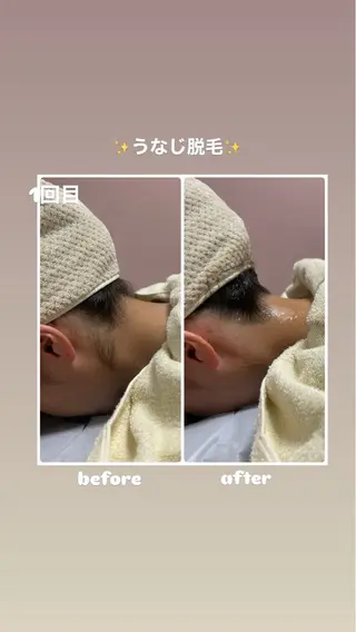 脱毛サロン エクボスタッフのエステ・リラクイメージ