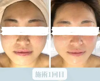 小顔&デコルテ Spa　“koti”のエステ・リラクイメージ