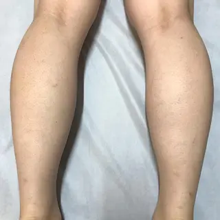 Lilyboo 星のエステ・リラクイメージ