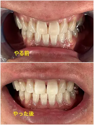 ホワイトニングジム 池袋のその他イメージ