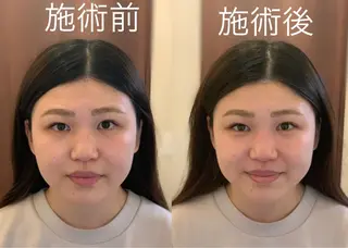 整体フェイシャル EMINALのエステ・リラクイメージ