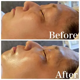 ár.ハーブピーリング専門店所属・ハーブピーリング 東大阪/瓢箪山のその他イメージ