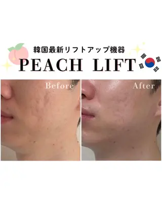 HETIY by Seoul所属・韓国肌管理🇰🇷 水光肌/肌質改善🫧のエステ・リラクイメージ