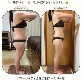 biloop所属・《本気痩せ×疲労改善 》  BILOOPのエステ・リラクイメージ