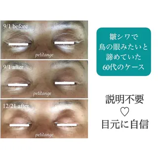 プチアンジェ所属・艶肌&小顔リフト❤︎ プチアンジェ茅ヶ崎のエステ・リラクイメージ