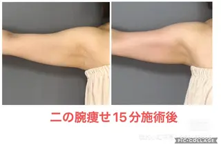 小顔コルギ10年 みなみ・池袋のエステ・リラクイメージ