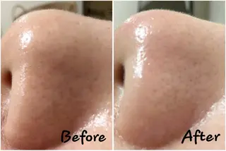 宮代・脱毛サロンMIIN所属・地域最安値の脱毛と 韓国美容【MIIN】のエステ・リラクイメージ