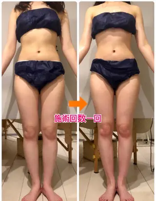 ロング カラー パーマ ヘアアレンジ メンズ キッズ ネイル マツエク・マツパ ‍痩身＆ボディ 結果出し🌟丹野のエステ・リラクイメージ