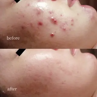 韓国肌管理・肌質改善 EARNEST心斎橋のエステ・リラクイメージ