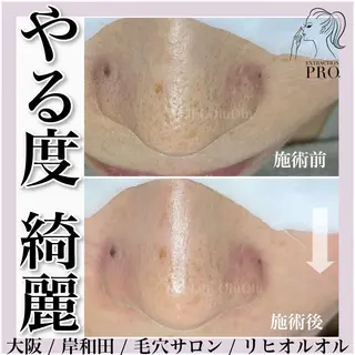 毛穴汚れ改善専門店/ 岸和田/リヒオルオルのエステ・リラクイメージ