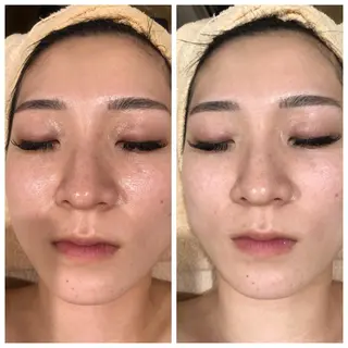 フェイシャル/脱毛 ジョアアンジェ　田中のエステ・リラクイメージ