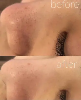 ララ/ハーブ メゾンリュバンのエステ・リラクイメージ