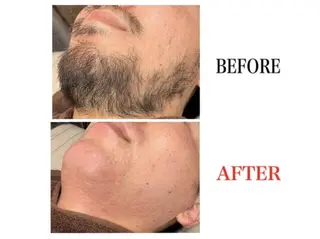 メンズ メンズ・ブリリアンス メンズ専用脱毛サロンのエステ・リラクイメージ