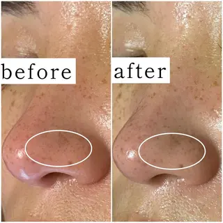 毛穴専門サロン　フルール所属・フルールFululu 自由が丘のエステ・リラクイメージ